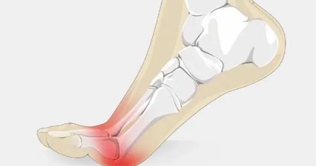 کفش تنگ یکی از عوامل عرق کردن کف پا است